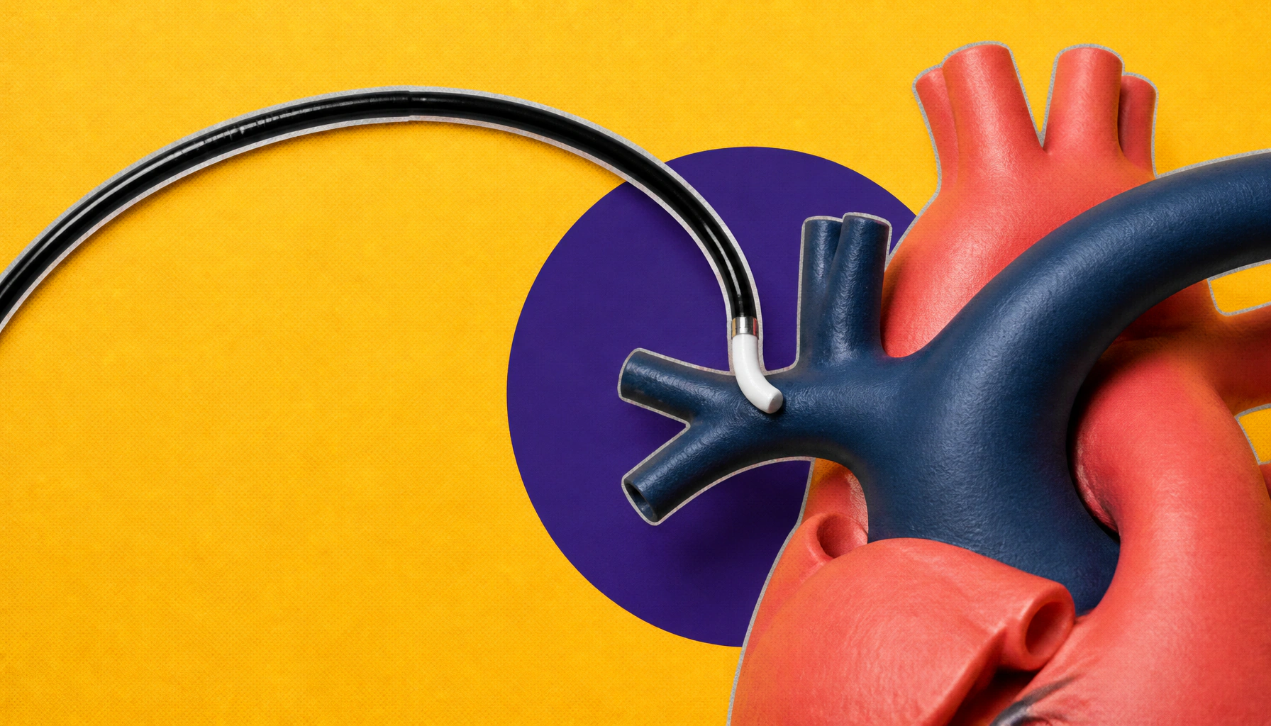 Nerve-blocking procedure cuts heart failure complications in half for pulmonary hypertension patients