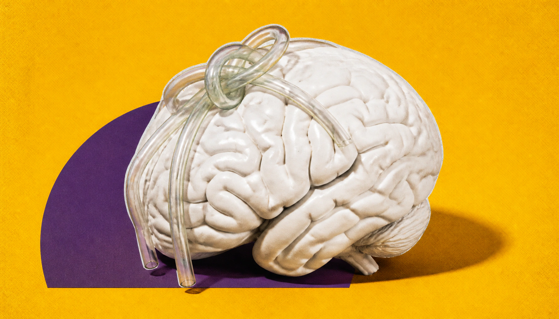 Sneaky misfolded proteins evade cellular cleanup — and may fuel Alzheimer's and aging
