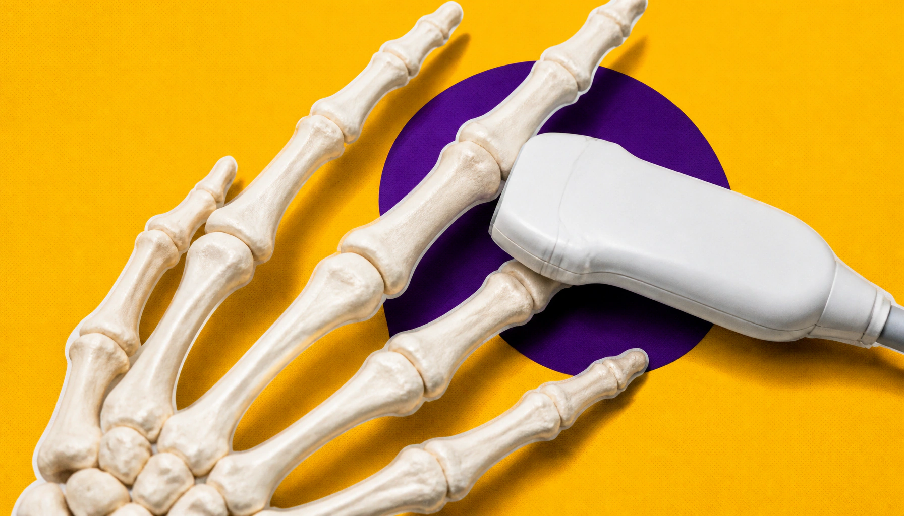 Rheumatoid arthritis vulnerability may be hardwired before birth
