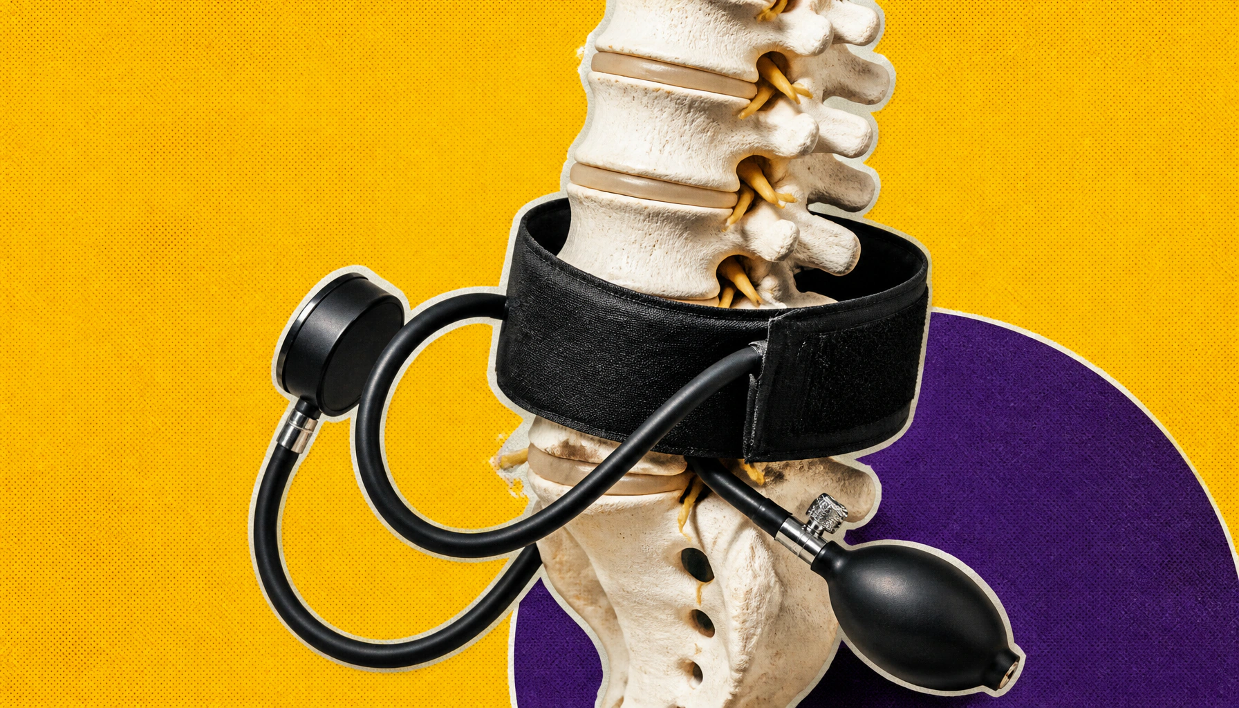 Stem cell discovery could unlock new treatments for lumbar spinal stenosis