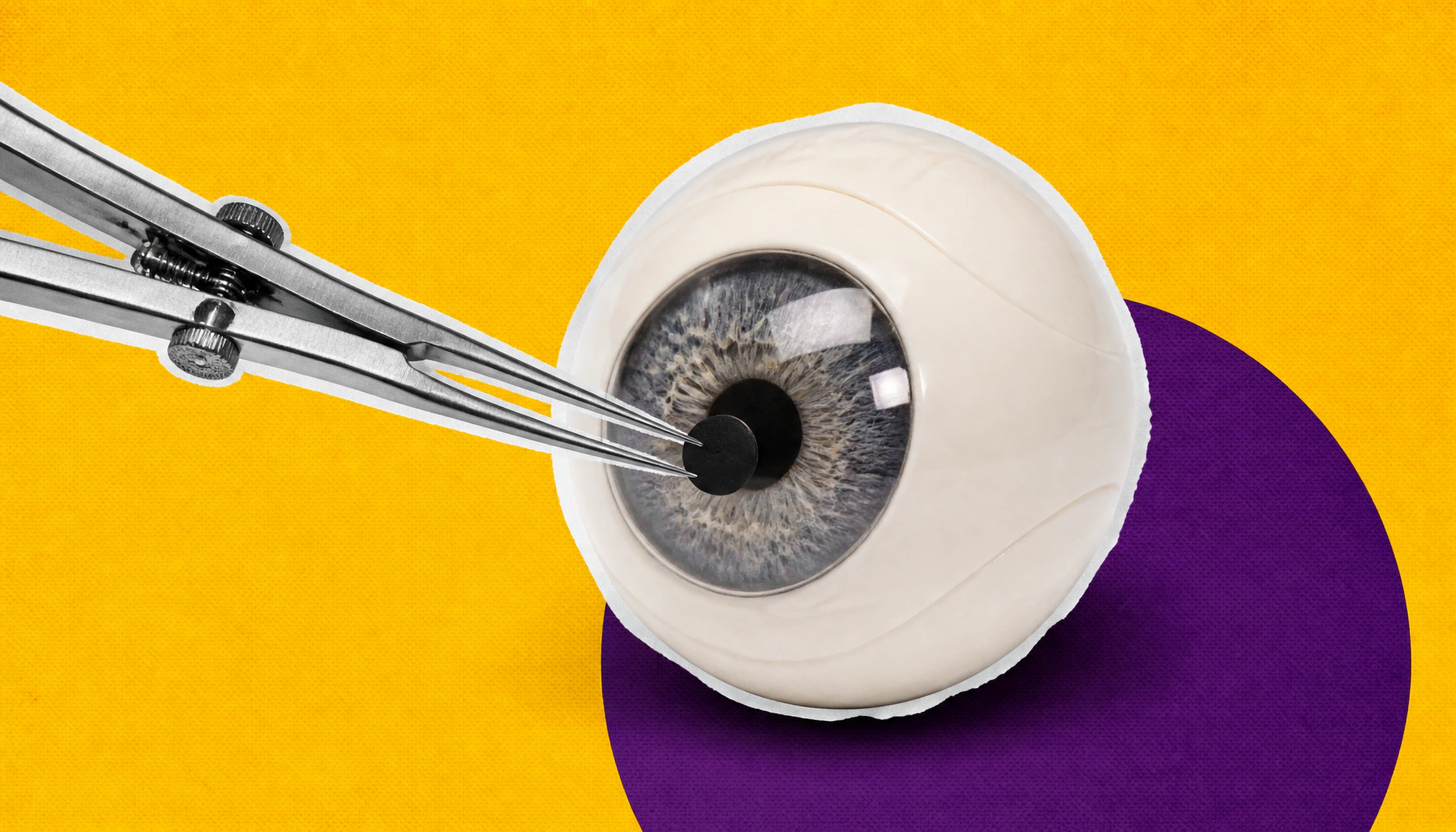 A new grading system for pinhole pupilloplasty could sharpen visual outcomes research