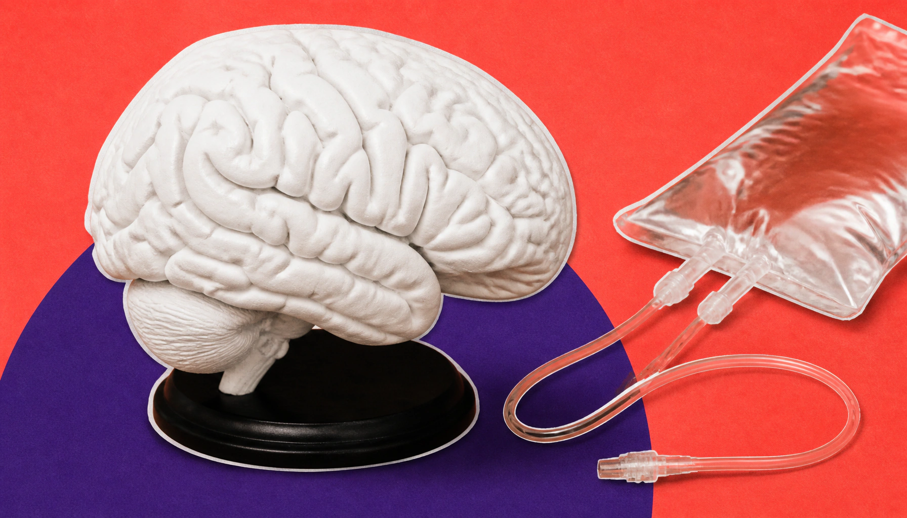 Cancer diagnosis nearly doubles stroke risk — and the first 3 months are the most dangerous