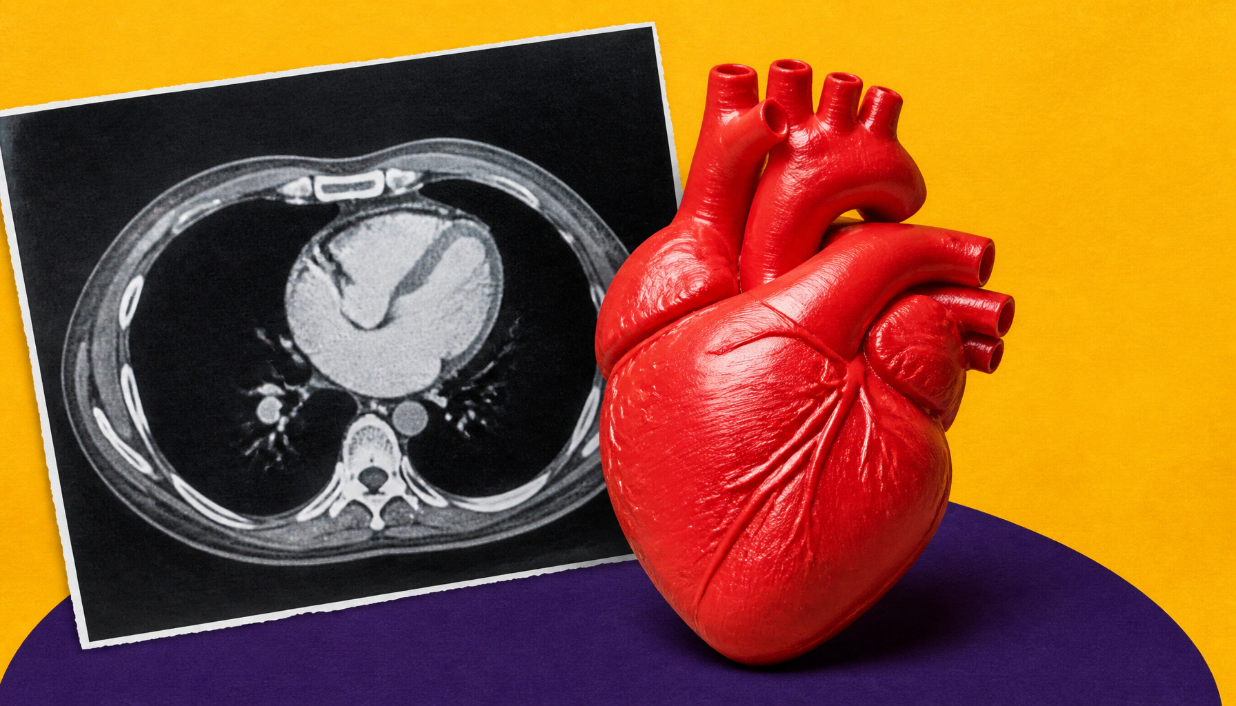 Heart calcium scans aren't for everyone — here's who benefits most
