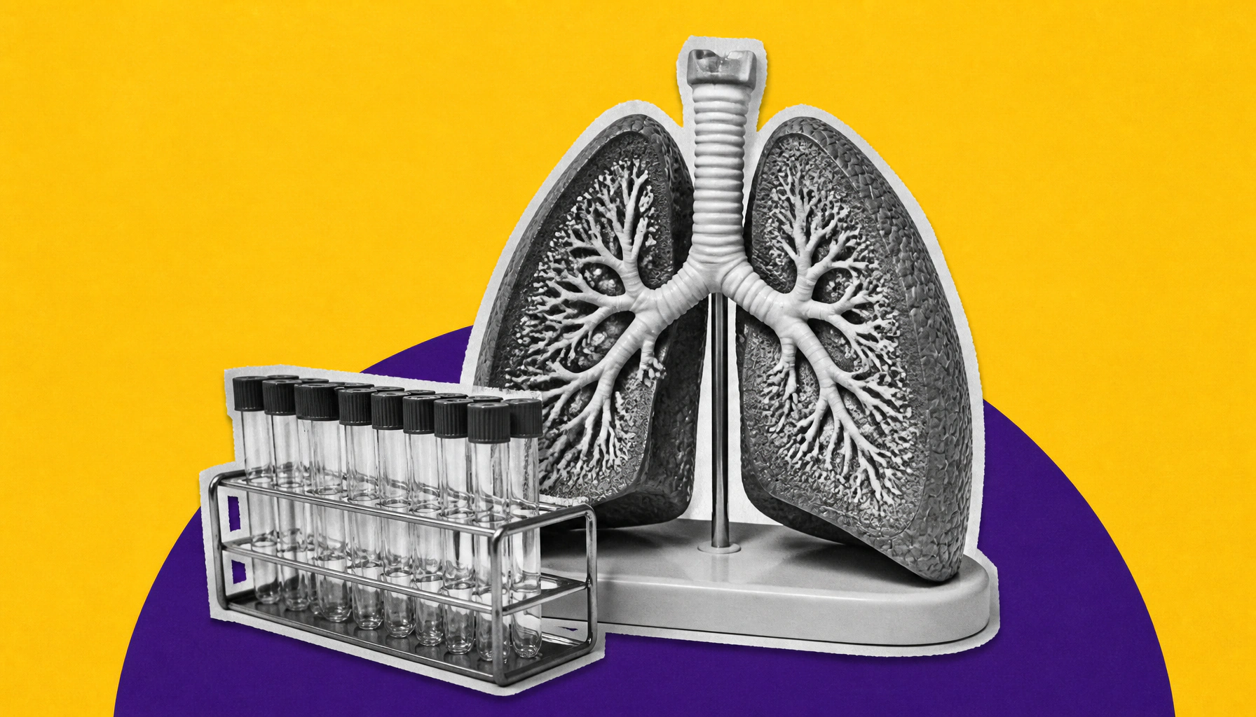 Precision medicine takes center stage at ILD Day 2026