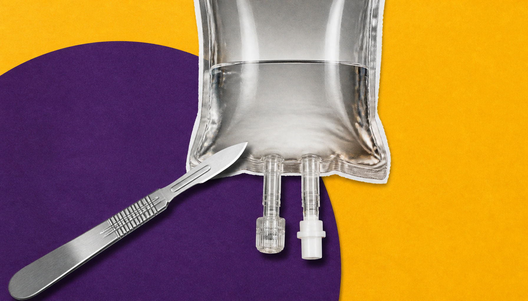 Durvalumab + chemo shows strong curative-intent outcomes in early-stage lung cancer