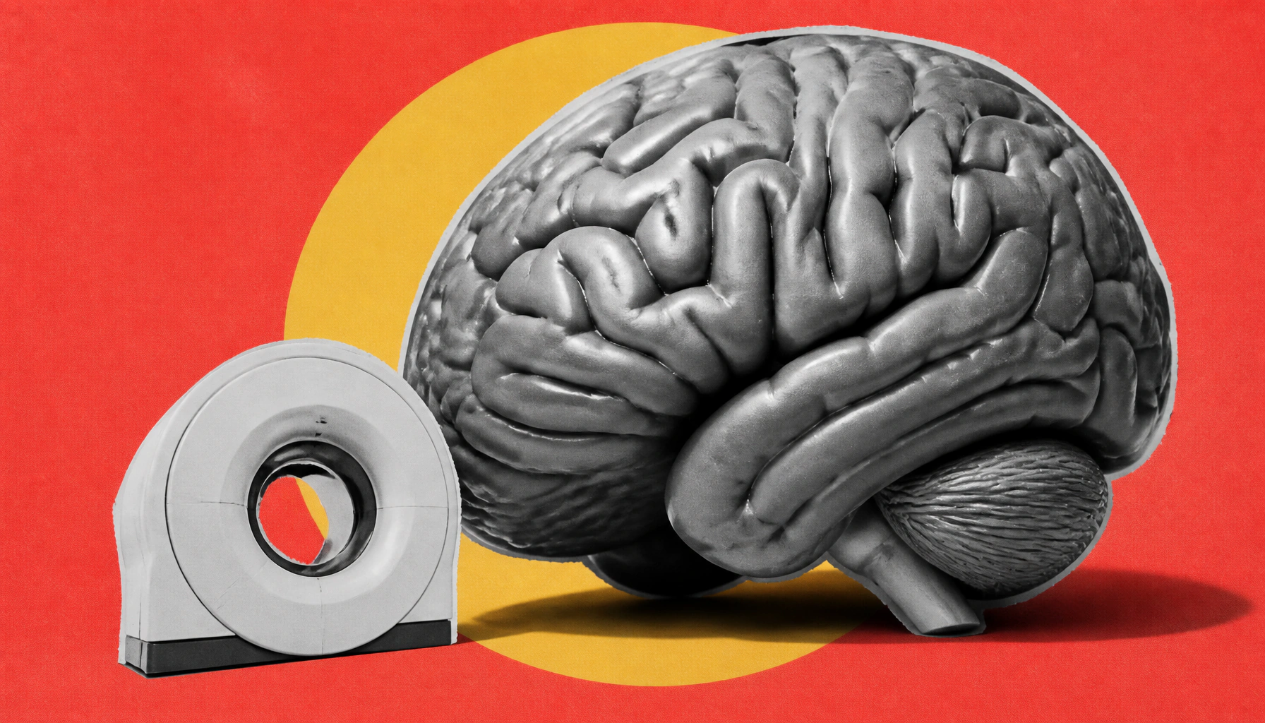 FDA clears AI-powered PET platform to sharpen Alzheimer's brain imaging