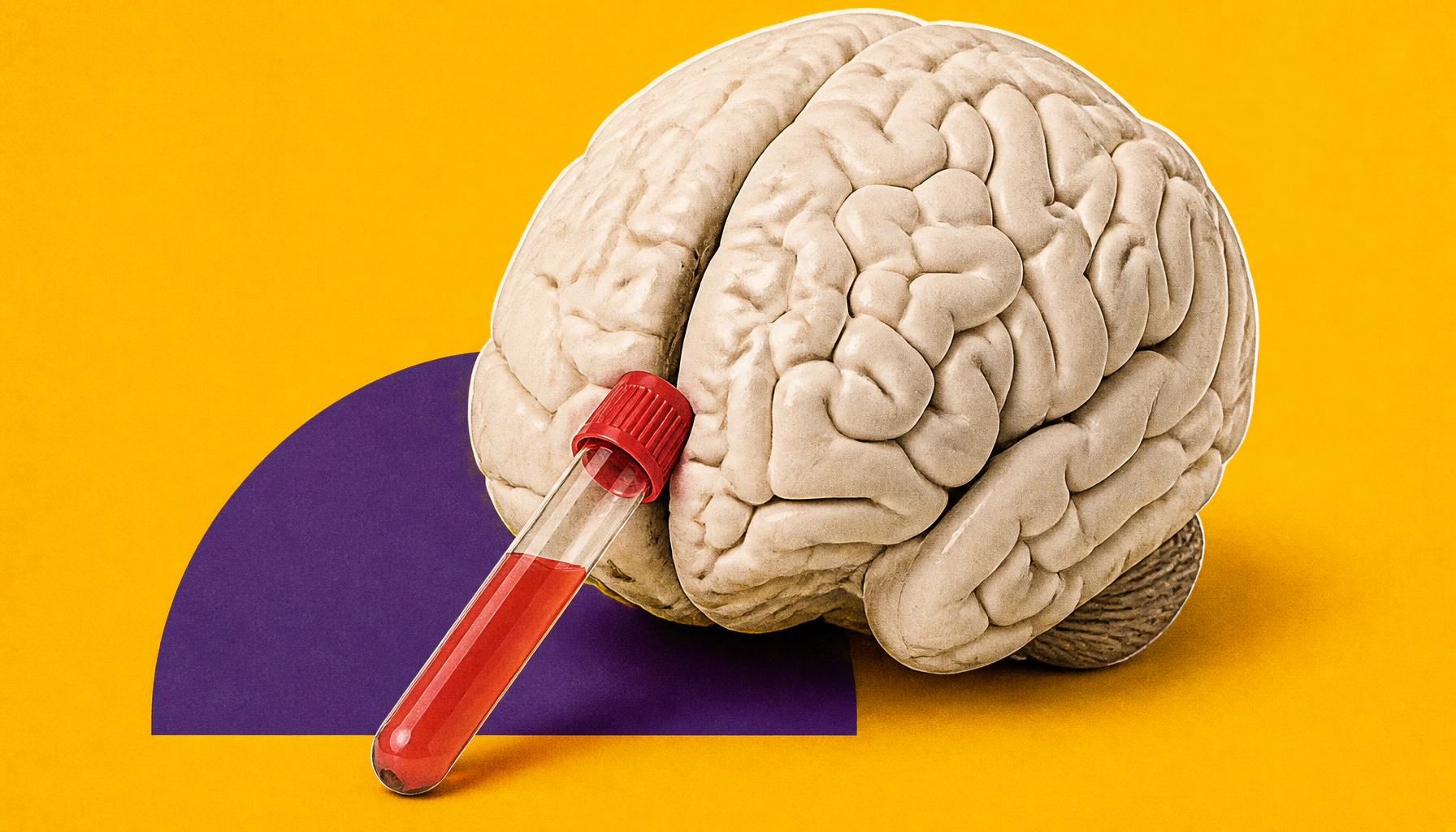 Your brain undergoes a dramatic makeover between ages 50 and 75