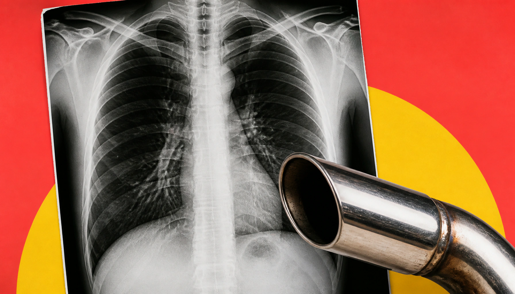 Breathing bad air worsens lung cancer survival — especially for nonsmokers