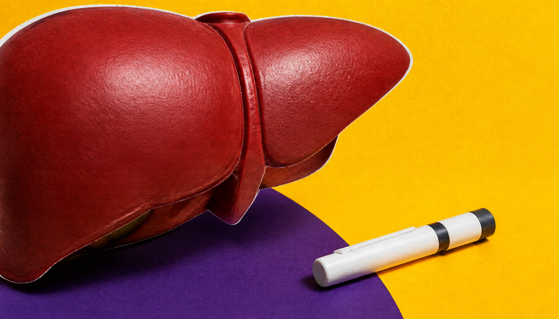 Diabetes and liver disease: why lifestyle changes must come first