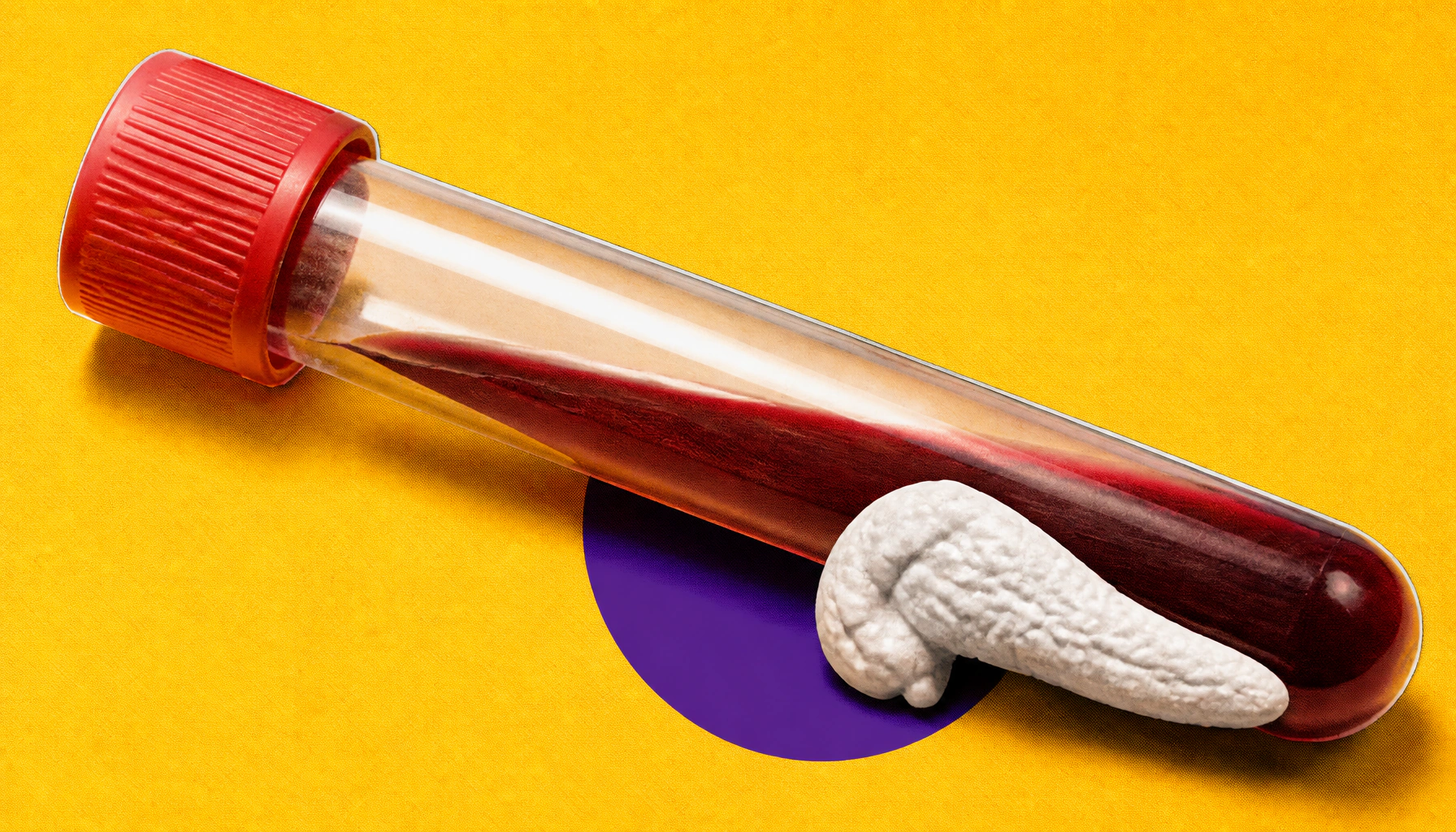 New blood tests are getting better at catching pancreatic cancer early — and that's a big deal