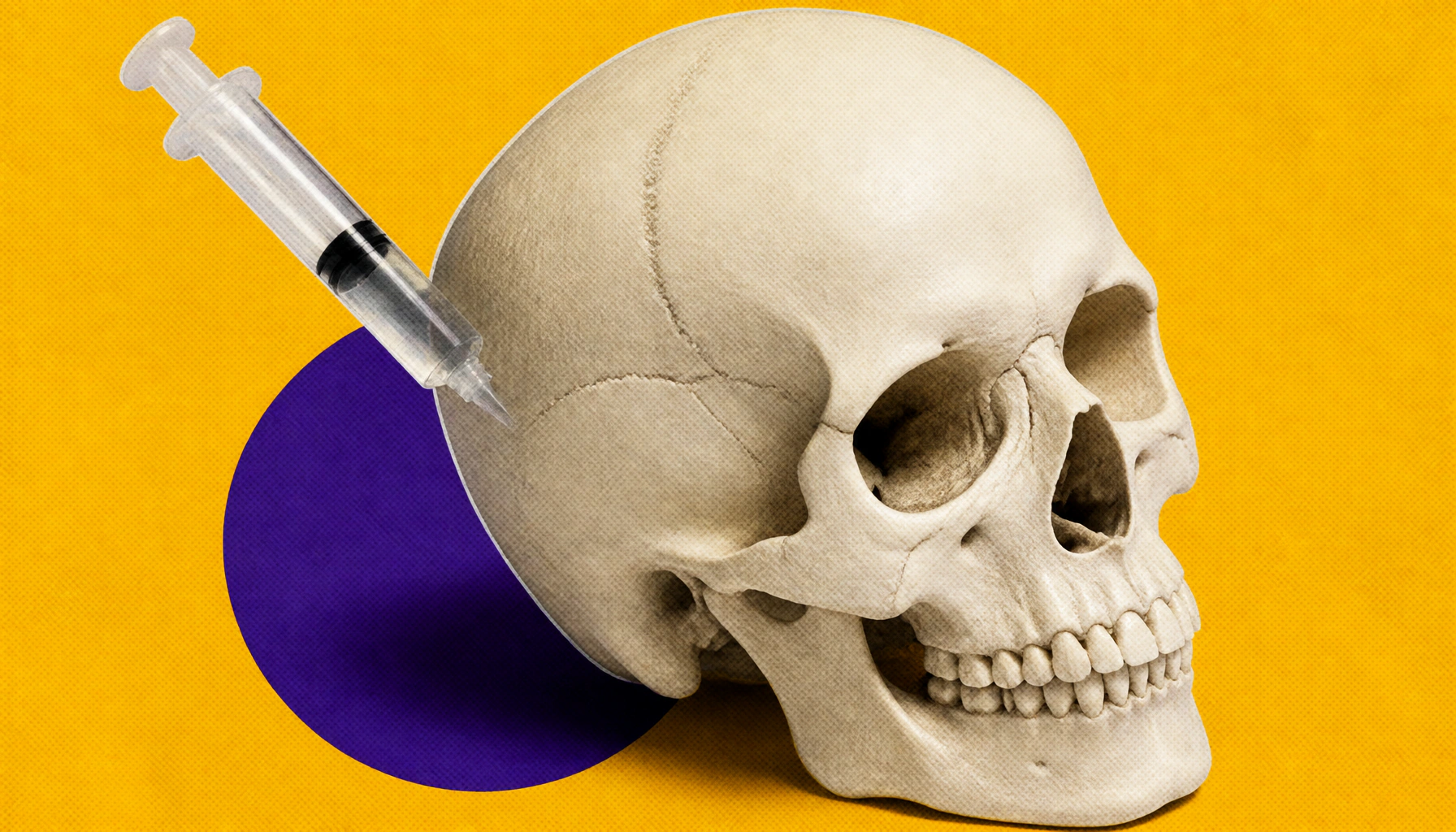 Skull harbors secret immune "security stations" that fight brain cancer
