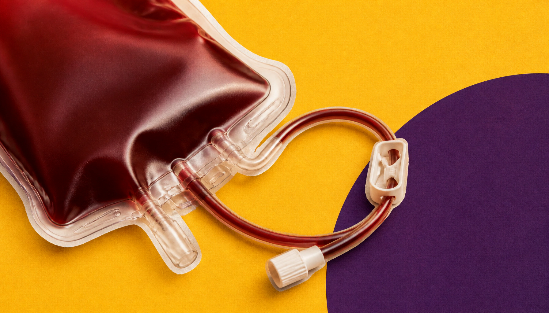 Allogeneic stem cell transplant offers hope for rare, aggressive lymphoma