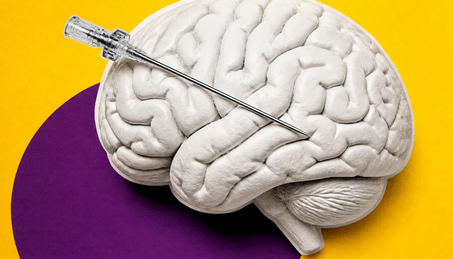 Alexander disease gets its first-ever treatment — here's what clinicians need to know