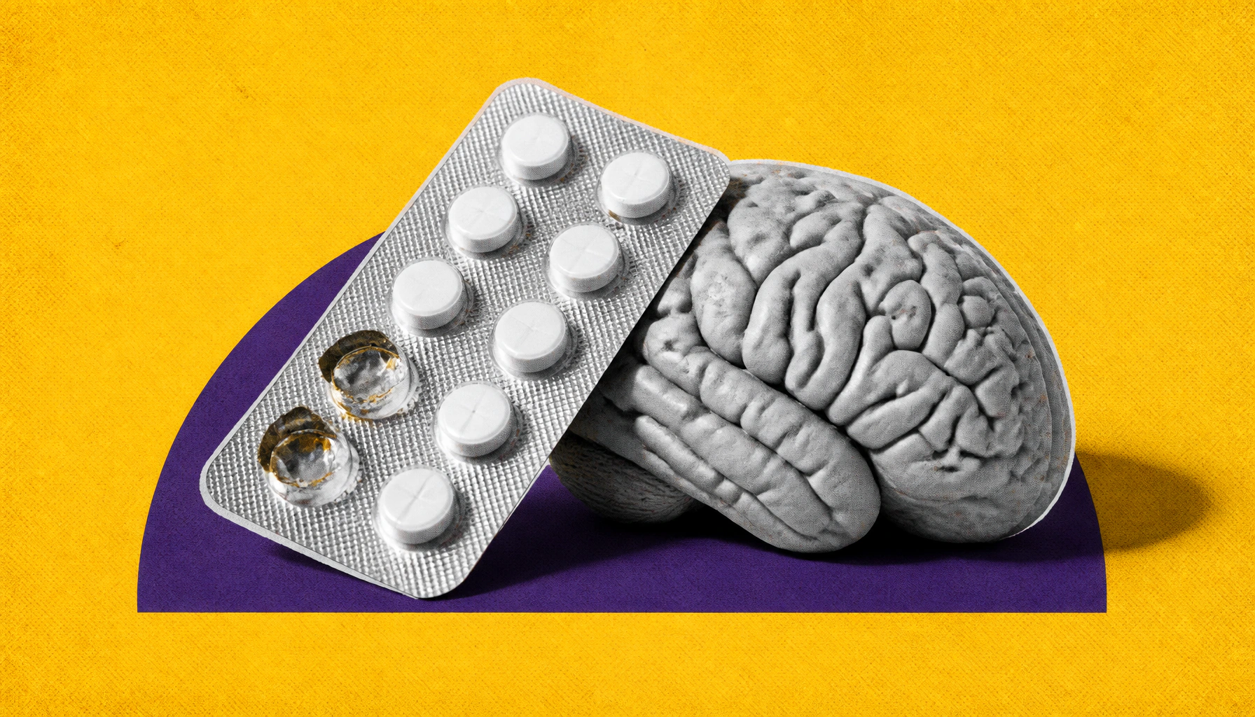 NOACs may slow cognitive decline in Alzheimer's patients with atrial fibrillation