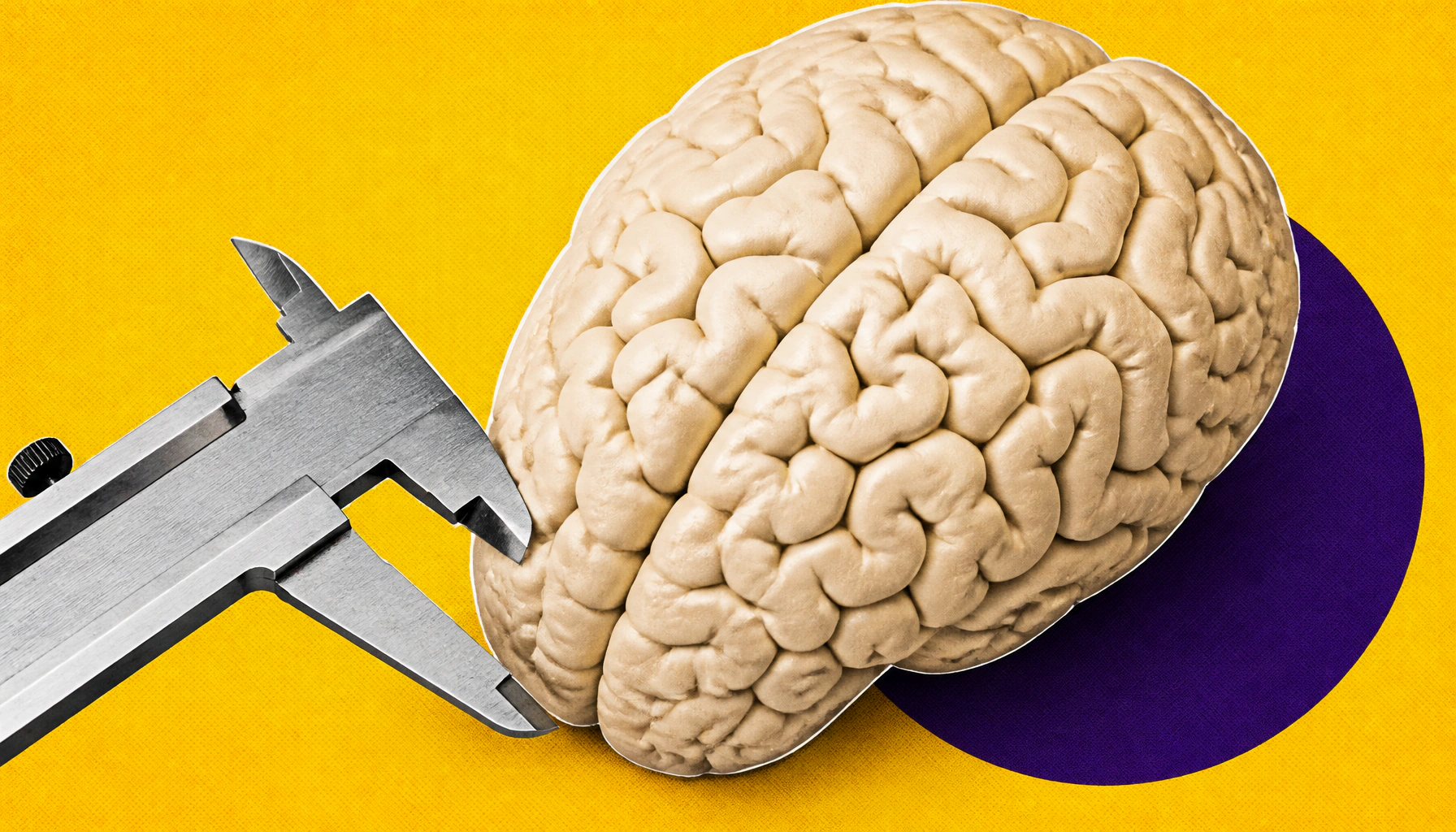 Bulimia nervosa leaves a measurable mark on the brain, landmark study finds