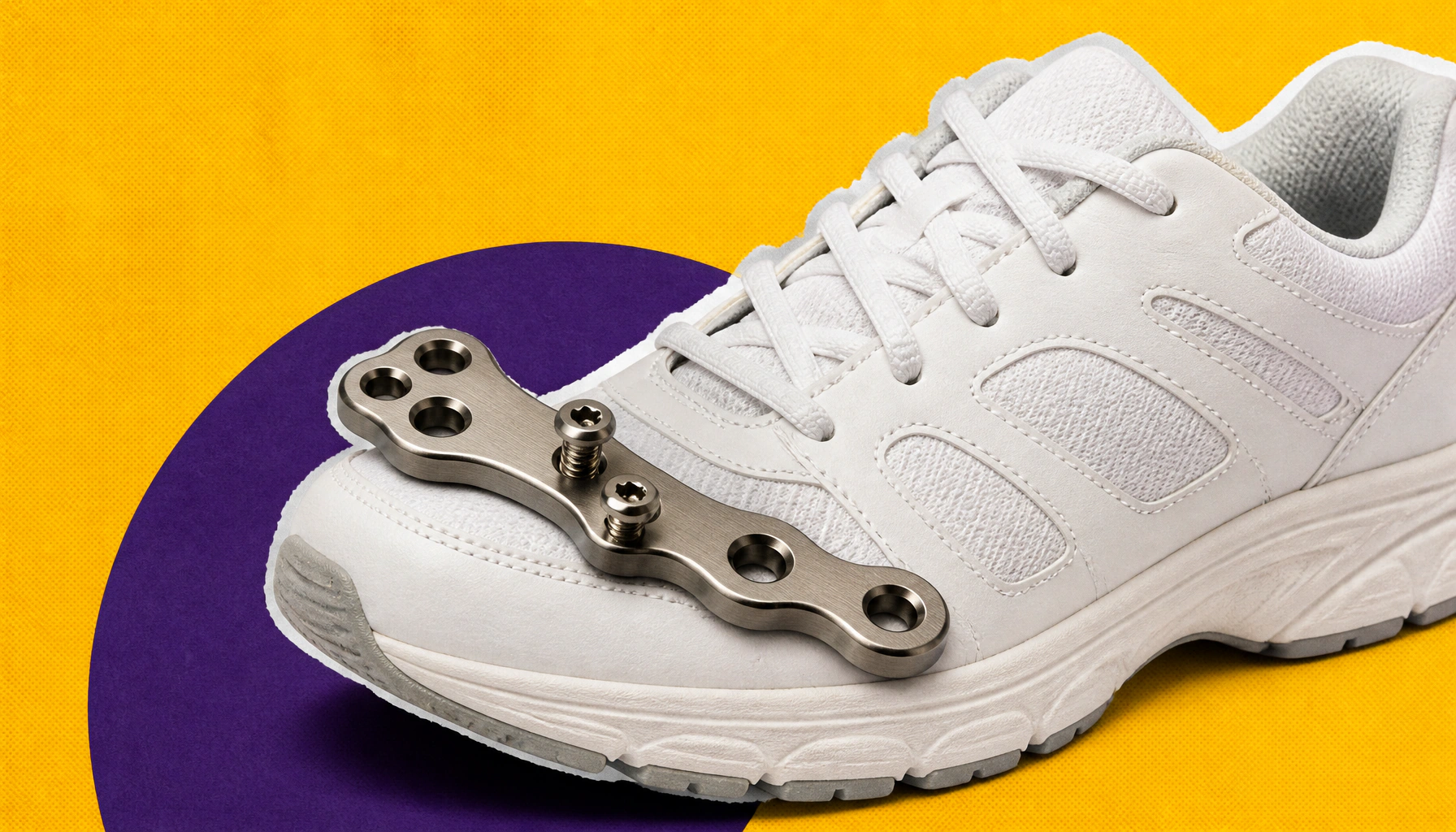 Smarter bunion surgery: Instrumented technique speeds recovery and boosts outcomes