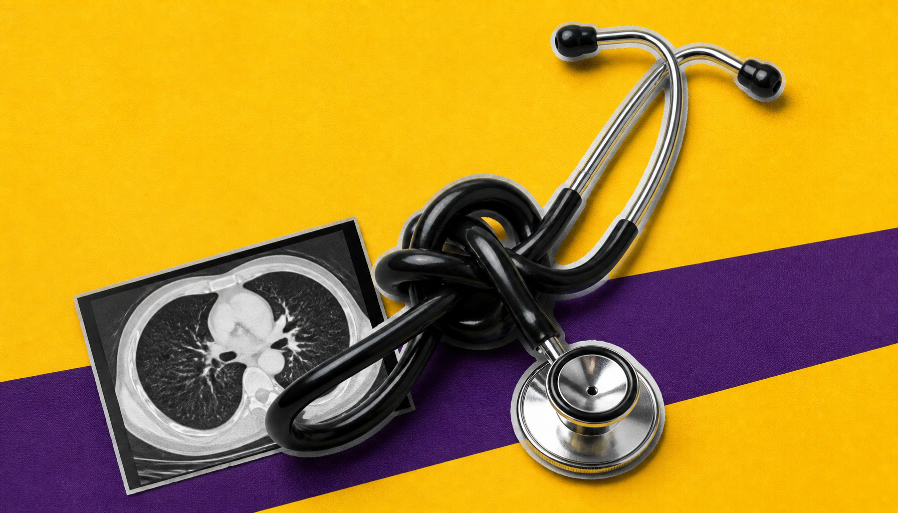 Lung cancer screening talks are rare — and the gaps are getting harder to ignore