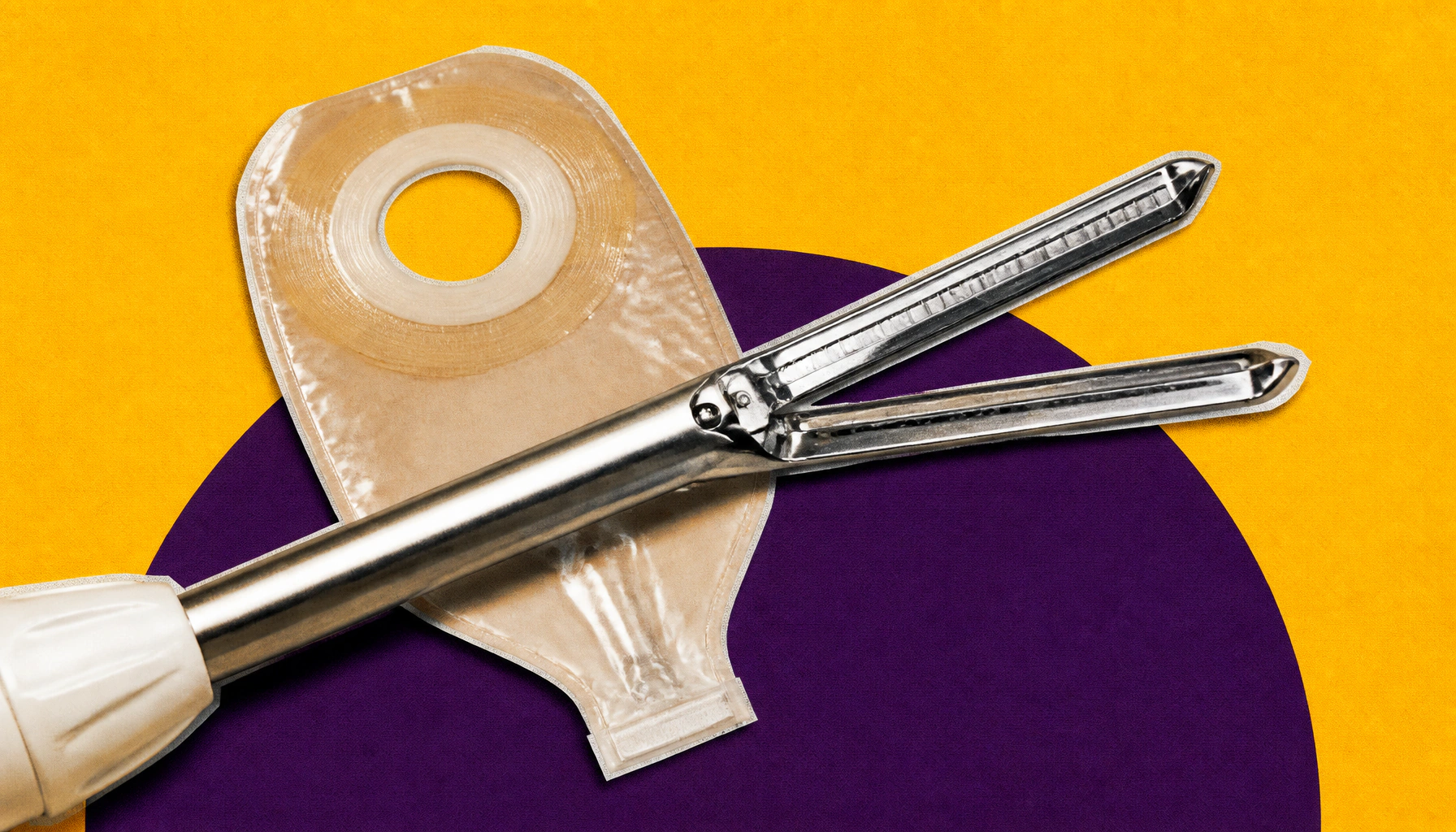 Intraoperative abscess alone doesn't doom Crohn's surgery outcomes, study finds