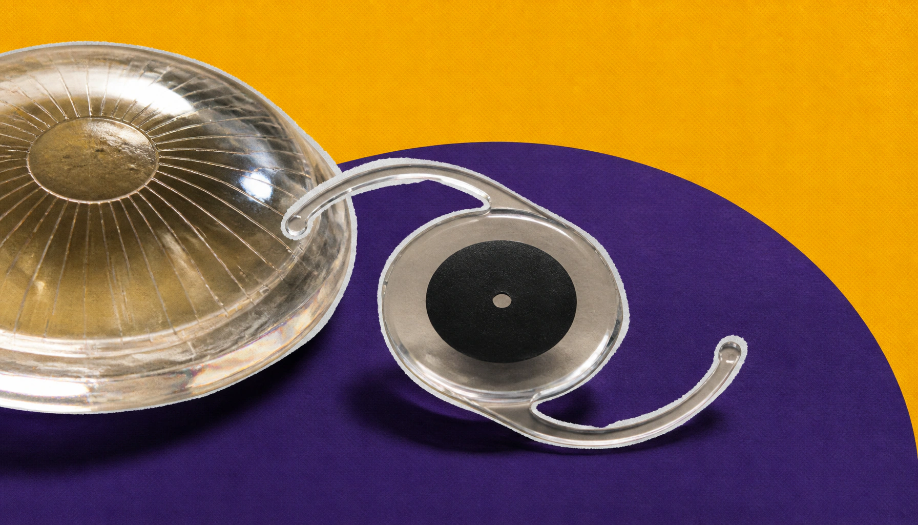 Cataract surgery in post-RK eyes: How to tackle daily vision swings with the right IOL