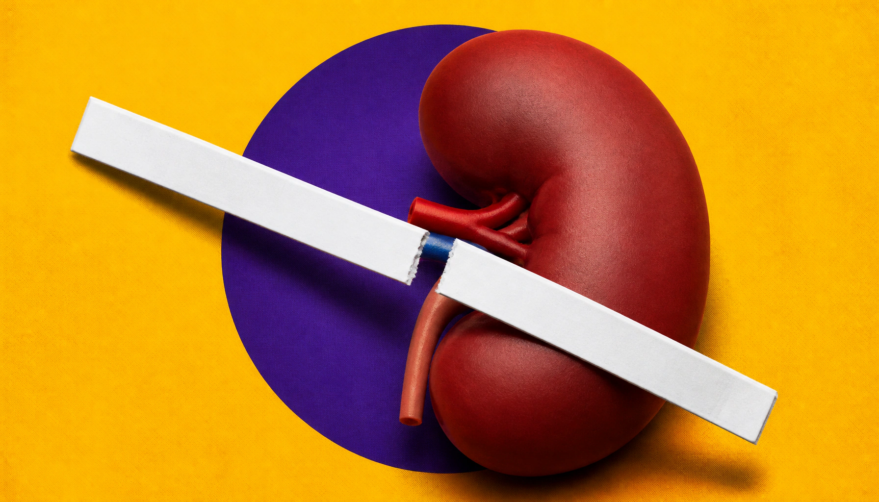 CKD screening is rising, but early-stage diagnoses are still lagging behind