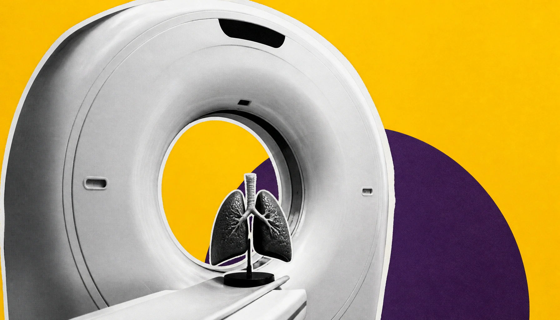 Routine imaging after lung cancer treatment linked to significantly lower death risk