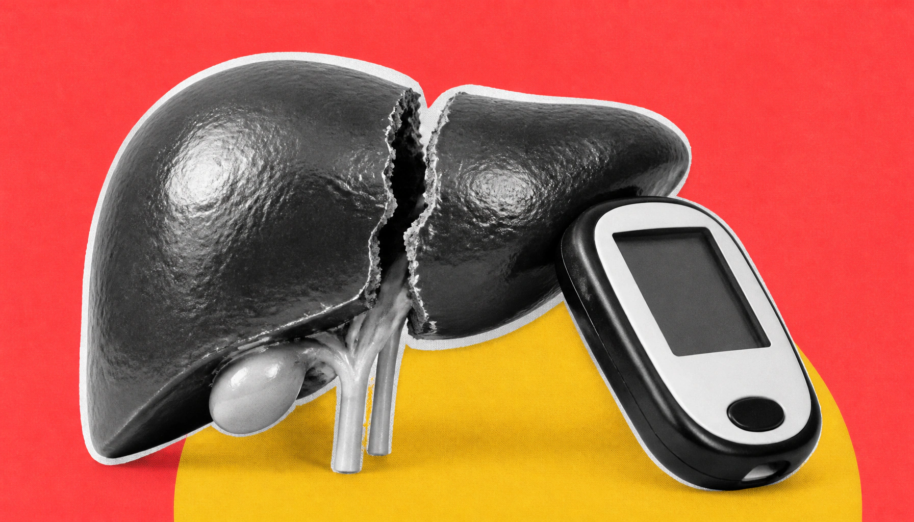 Young-onset liver cirrhosis linked to genetics and diabetes — and current screening tools are missing it