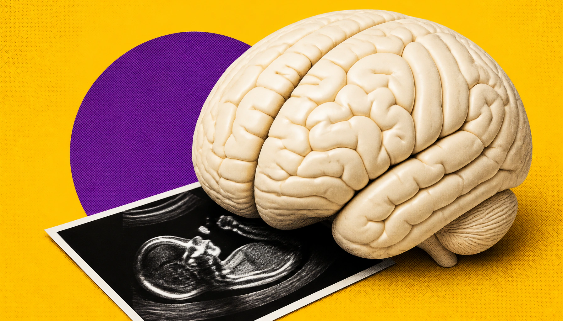 Rare brain tumor behind sudden vision loss in pregnant woman