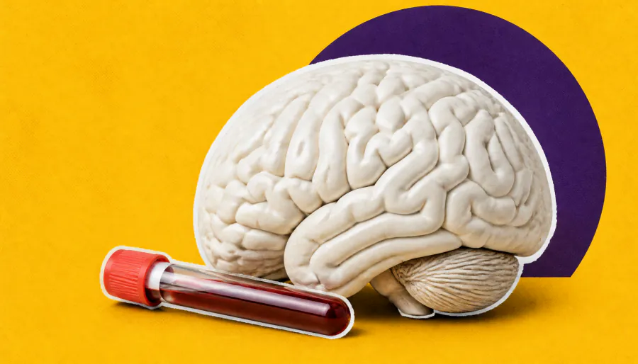 Fibromyalgia is a brain disorder, not an autoimmune disease — here's what the latest science says