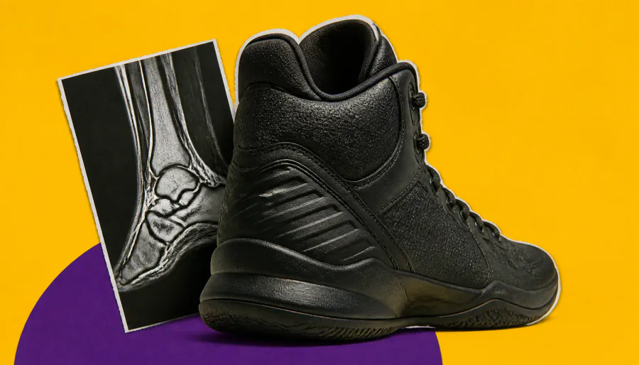 Calf strain history raises Achilles rupture risk in NBA players, study finds