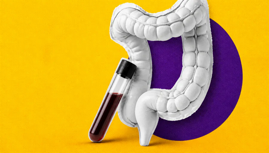 Genomics 101 for oncology nurses: What you need to know about colorectal cancer