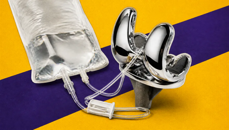 A faster joint infection fix? Rapid exchange arthroplasty outperforms the standard two-stage approach