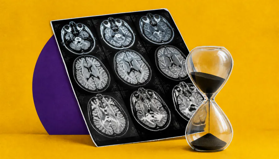 MRI study maps how different brain disorders accelerate aging in distinct ways