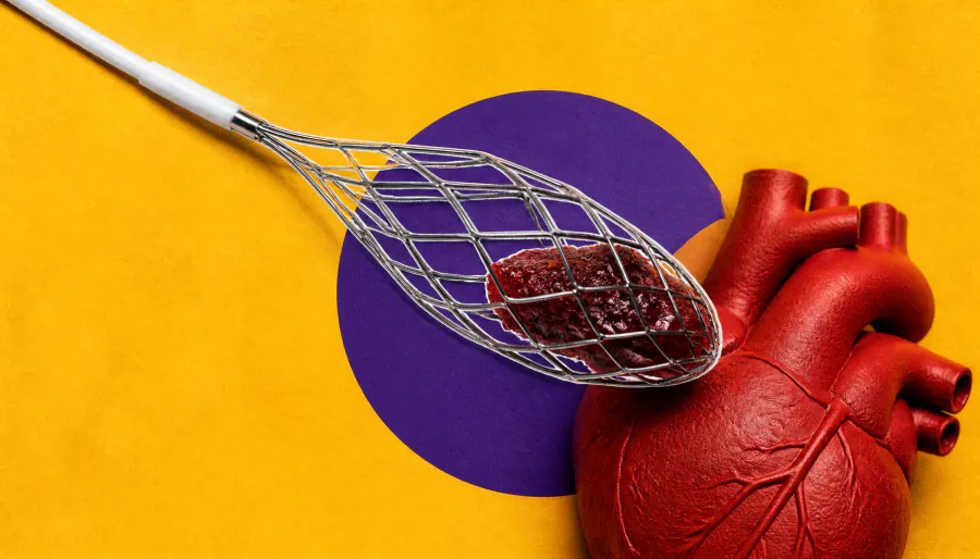 Clot-removal technique before stenting cuts heart attack damage by 26%