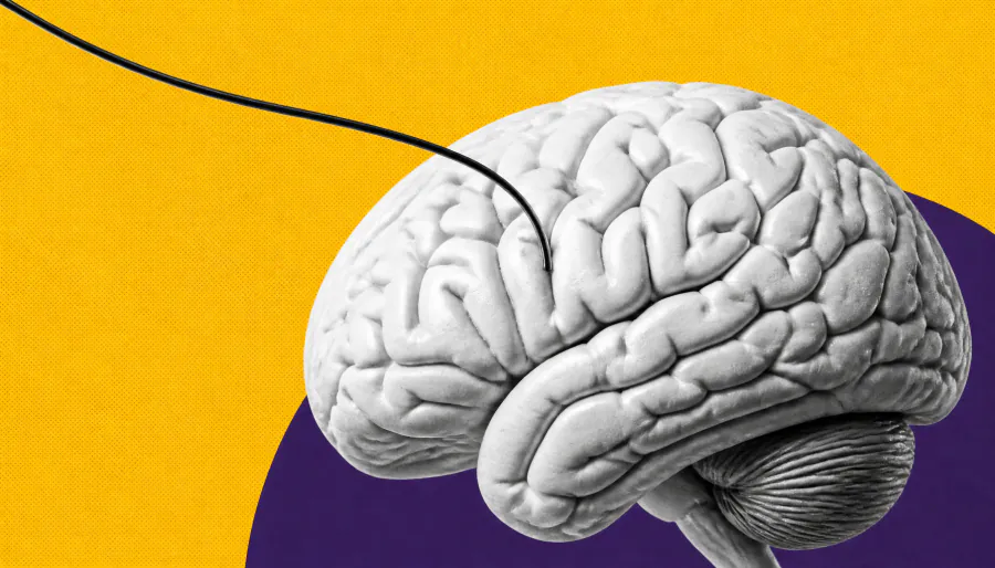Mount Sinai and J&J team up to explore a new targeted radiation approach for brain tumors