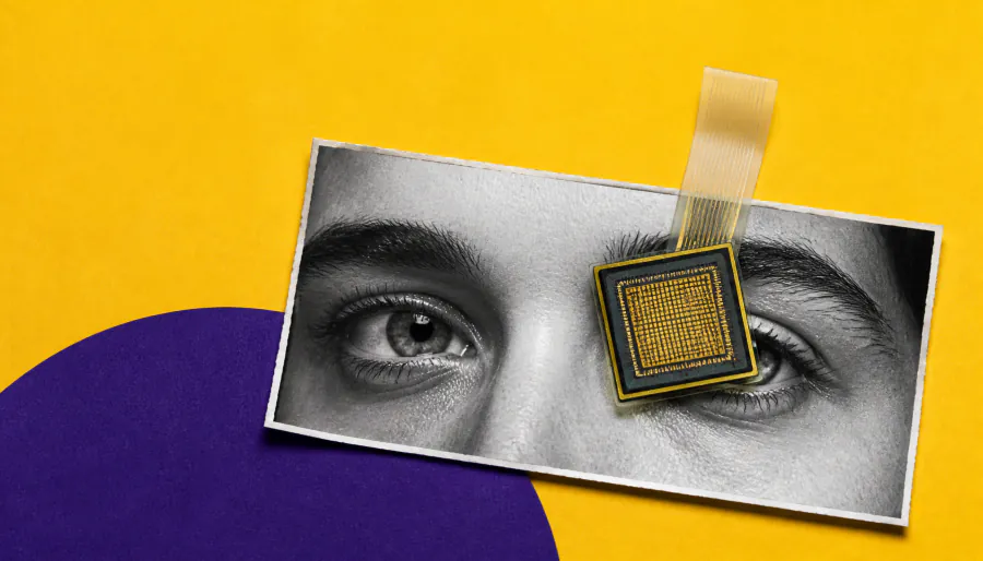 Retinal implant helps geographic atrophy patients read and recognize faces