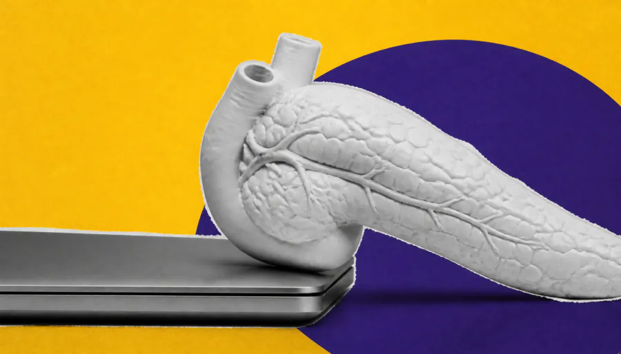 AI model predicts pancreatic cancer risk up to 5 years before diagnosis