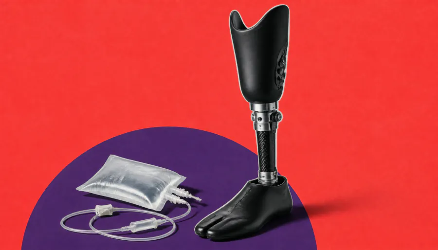 Below the knee, above the stakes: Amputation carries serious long-term risks