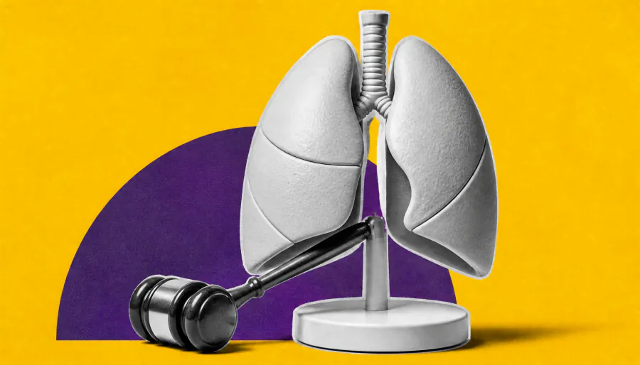 North America finally gets its first bronchiectasis guideline — here's what clinicians need to know
