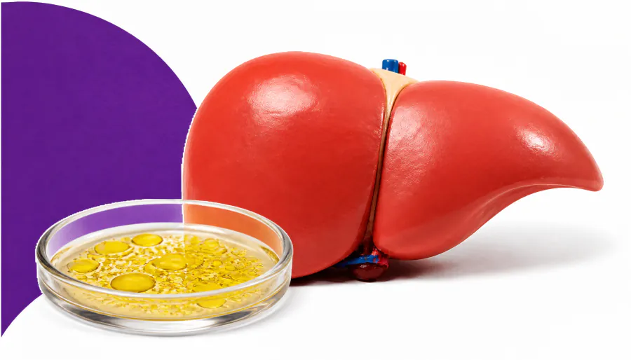 Scientists discover a natural enzyme that may put the brakes on fatty liver disease