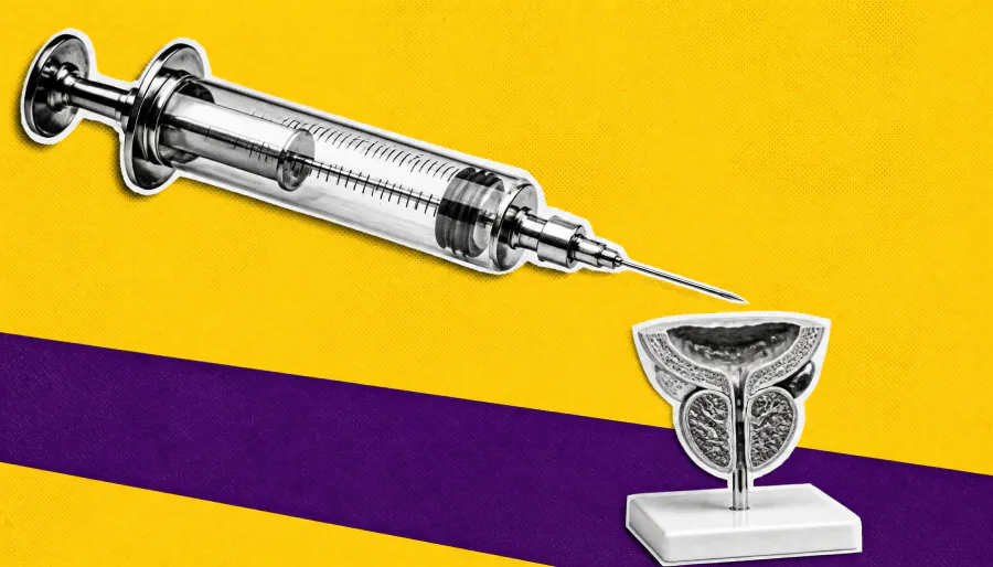 Prostate cancer immunotherapy combo cuts recurrence risk by 41% with lasting immune response