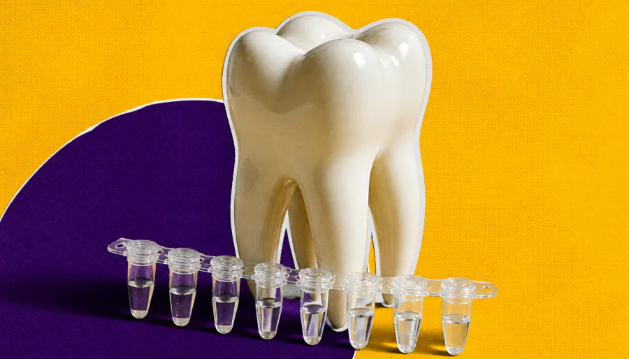Your genes may explain why your teeth are the first to suffer in this rare bone disease