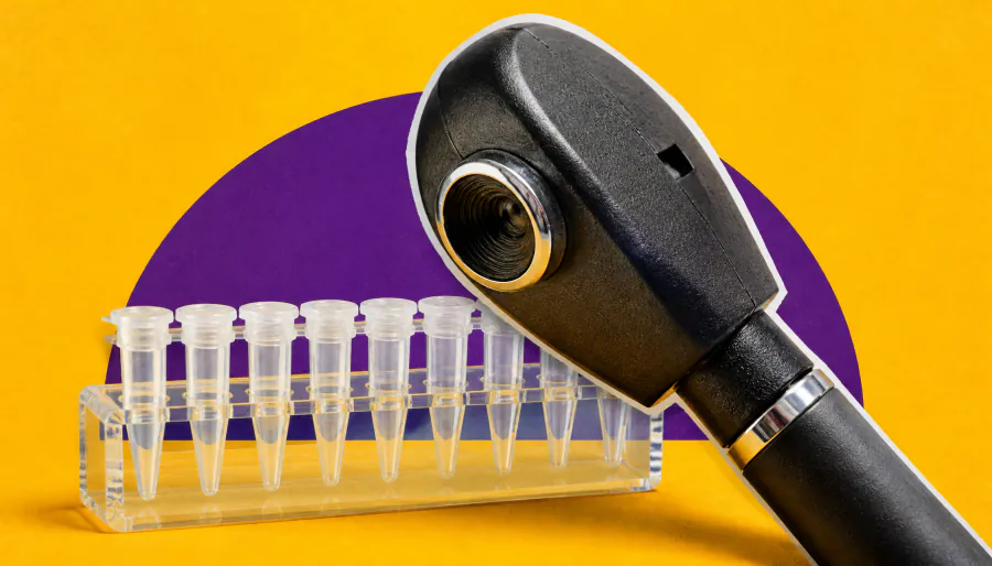 Blindness gene surprise: A metabolic disorder gene is behind some unexplained vision loss