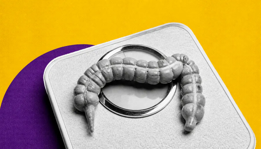 The "obesity paradox" in colorectal cancer may be a statistical illusion — here's why