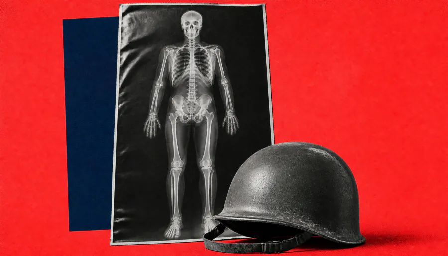Military blast exposure is a whole-body problem, not just a brain injury