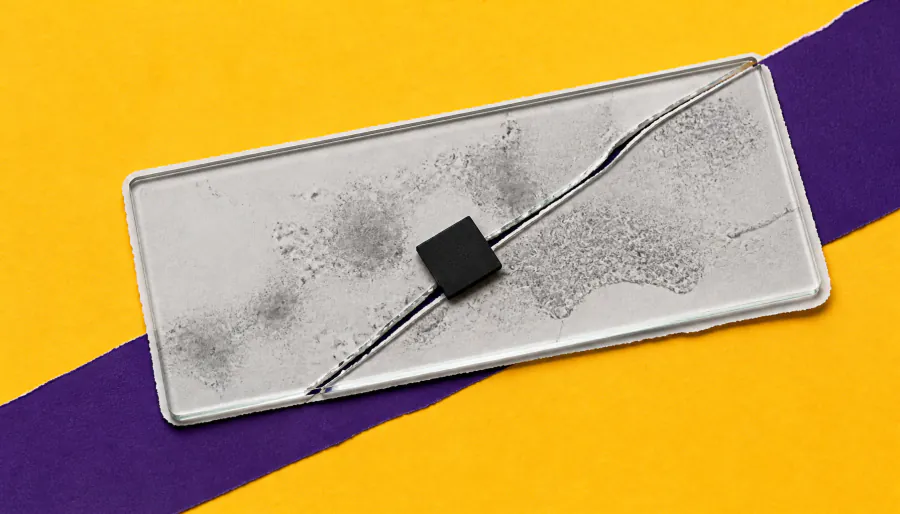 SPARCS: The AI-powered microscopy tool that's transforming genetic cell screening