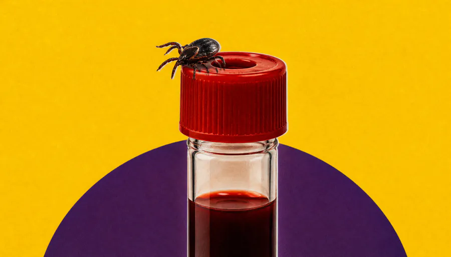 Lyme disease patients are frequently co-infected with other tick-borne pathogens
