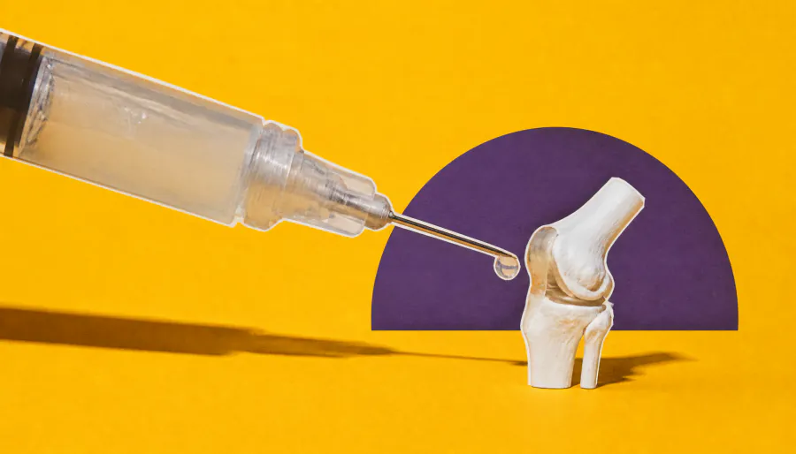 An epilepsy drug + a smart gel could be osteoarthritis's worst nightmare