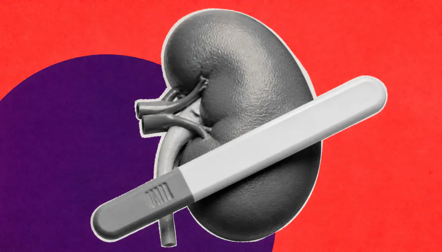 Women with chronic kidney disease are being underdiagnosed — and the medical system is partly to blame