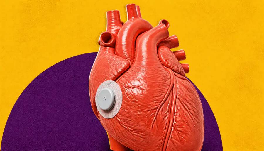 Your glucose monitor could predict heart disease risk — even if you don't have diabetes