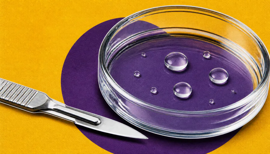 IVF shows strong success rates for women with IBD, even after pelvic surgery